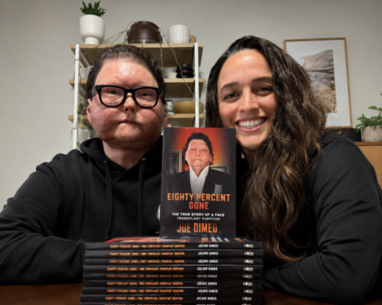 Joe svoj príbeh opísal v autobiografickej knihe Eighty Percent Gone, One Hundred Percent Strong (Oheň mi vzal osemdesiat percent tela, no nie silu žiť: Príbeh návratu vďaka nezlomnosti).